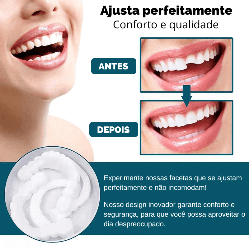 Facetas Dentárias Universal - Smile